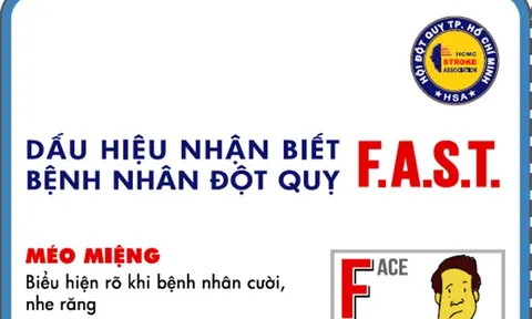 Khi nào và ai nên tầm soát đột quỵ?