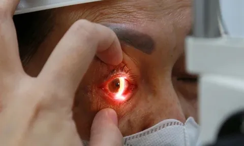 6 "không" trong thời điểm dịch đau mắt đỏ đang diễn biến phức tạp