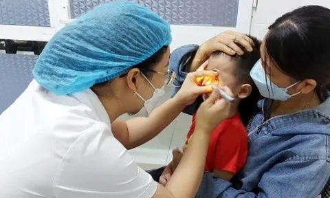 Cảnh báo biến chứng khi tự ý xông lá, đắp lá... khi trẻ bị đau mắt đỏ