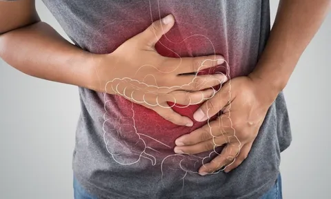 Hiệp hội Ung thư Hoa Kỳ: 6 việc cần làm sớm để ngăn ngừa ung thư đại trực tràng