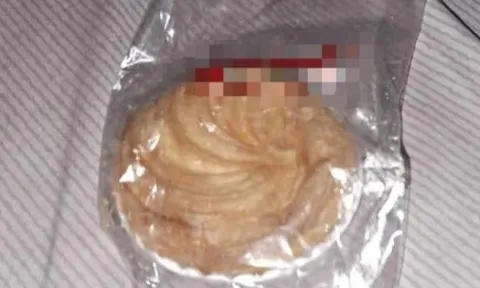 Bé 6 tuổi ngộ độc sau tiệc Trung thu: Lập hội đồng đánh giá quy trình tiếp nhận