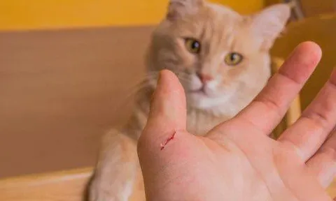 Người đàn ông 35 tuổi hôn mê, phải thở máy do bị mèo cắn