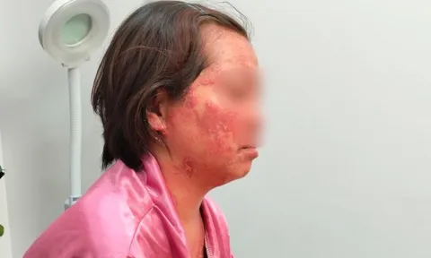 Nỗi đau của người phụ nữ mắc căn bệnh nhiều người không dám đến gần