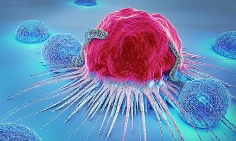 5 triệu chứng cảnh báo sớm ung thư: Có 1 dấu hiệu cũng cần đi khám