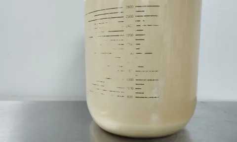 Ca bệnh hiếm gặp được điều trị bằng phương pháp rửa phổi