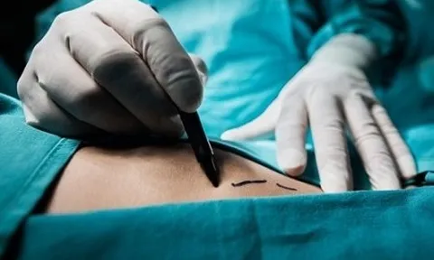 Bộ Y tế chỉ đạo khẩn sau thông tin phản ánh đường dây mua bán thận