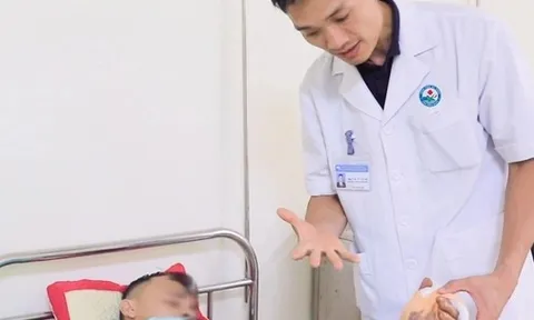 Điện thoại bất ngờ phát nổ khi sạc pin, người đàn ông dập nát bàn tay