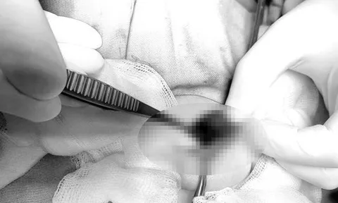 Bé trai 2 tuổi phải cắt bỏ tinh hoàn căn bệnh dễ gặp, cha mẹ thường bỏ qua dấu hiệu cảnh báo