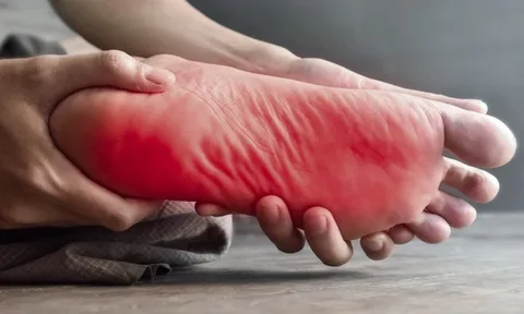 Cảm giác kiến bò ở lòng chân có thể cảnh báo bệnh lý mãn tính nguy hiểm