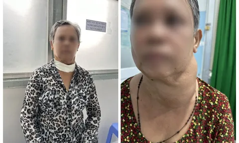30 năm sống chung với bướu cổ, thở không được mới đi khám