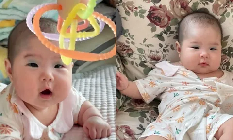 Em bé chào đời với vết bớt độc nhất vô nhị trên mặt, cư dân mạng đùa rằng: "Bé trang điểm để gặp mẹ"