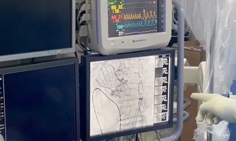 CLIP: Thay van trong van tim lần đầu tiên tại Việt Nam