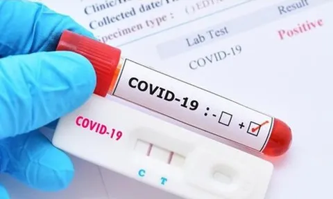 Ngày 20/10 đánh dấu bước ngoặt của dịch COVID-19 tại Việt Nam