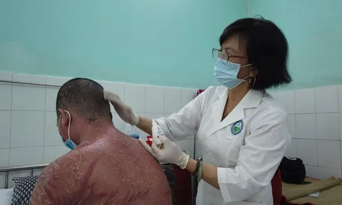 Mua thuốc vảy nến trên mạng biến chứng toàn thân