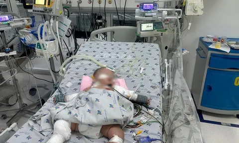 Bé 5 tháng tuổi nguy kịch do sốc sốt xuất huyết
