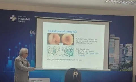 Phát hiện bệnh u phổi hiếm gặp ở người trẻ