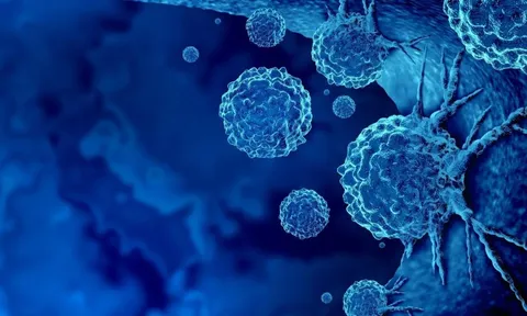 Mỹ: Tìm ra “công tắc” khiến tế bào ung thư tự hủy diệt