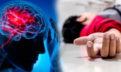 Thanh niên 20 tuổi mắc nhồi máu não, bác sĩ sửng sốt vì ‘mạch máu như người 50 tuổi’: Nguyên nhân do đâu?