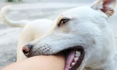 Theo bố đến chỗ làm, bé gái ở Hà Nội bị 4 con chó tấn công