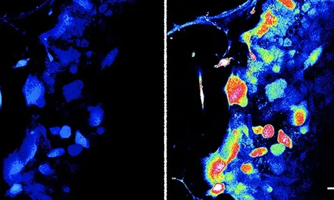 Phát hiện cơ quan xúc giác hoàn toàn mới ở người