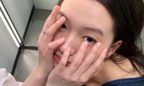 Gan khỏe hay không nhìn da là biết, thấy “đỏ, đen, vàng” này phải đi khám ngay