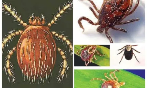 Ca sốt mò đầu tiên tại phía Nam: Nguy kịch chỉ vì một vết đốt