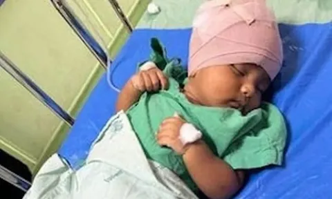 Khỉ hoang đột nhập vào nhà, cắn chảy máu đầu bé trai 3 tháng tuổi