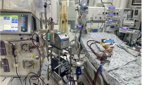 Cứu 2 anh em bị ong vò vẽ đốt hàng chục vết nguy kịch