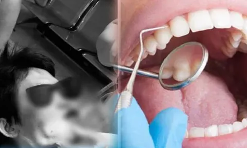 Lần đầu đi lấy cao răng bị chảy máu ồ ạt, bệnh nhân không ngờ bị ung thư máu