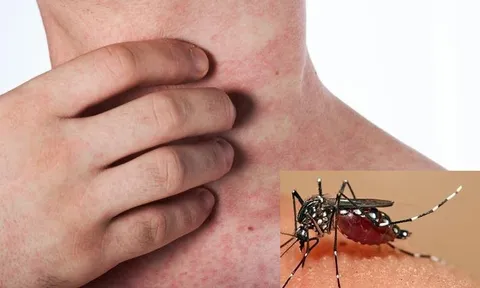 Mắc căn bệnh quen thuộc, người phụ nữ không thể ngủ vì cảm giác "giòi bò trong xương"