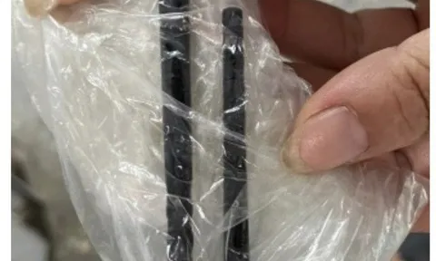 Đau đầu, người đàn ông đến bệnh viện mới biết bị đũa đâm từ mũi lên não