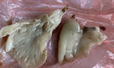 7 người cấp cứu do ăn phải nấm ma