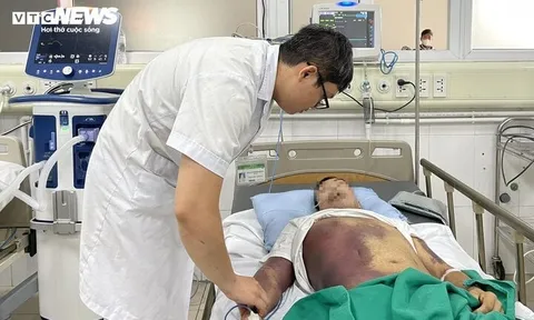 Tím đen toàn thân, gia đình phải xin đưa về sau 2 tuần điều trị sốt xuất huyết