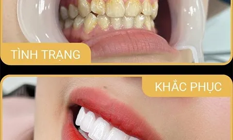 Nhiều phòng khám nha khoa bị xử phạt hàng trăm triệu đồng