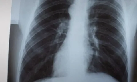 Thái Lan sẵn sàng các phương án đối phó với khả năng bùng dịch hô hấp ở trẻ