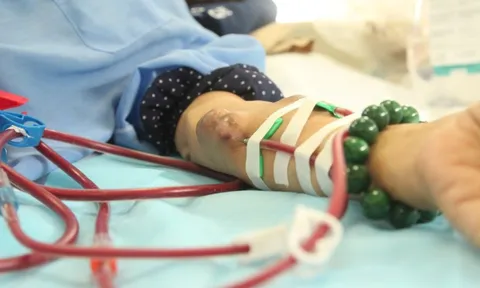 Nhiều người trẻ suy thận nhưng phát hiện rất muộn: 4 dấu hiệu cảnh báo ai cũng nên biết