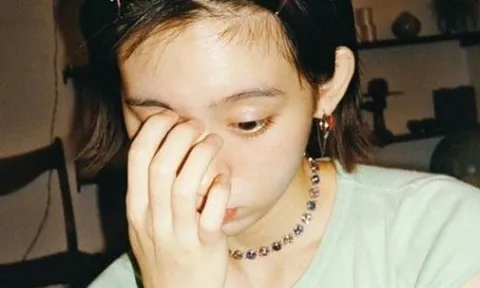 Thấy gân xanh nổi rõ ở 4 nơi này trên cơ thể tốt nhất là mau đi khám