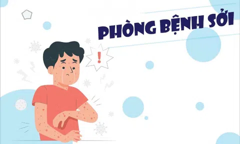 Infographics: Bệnh sởi và các biện pháp phòng bệnh