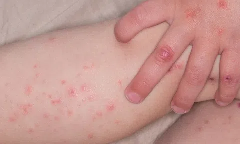 Hà Nội cảnh báo nguy cơ dịch bệnh trước thềm lễ lớn