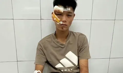 Lời khai của quái xế "thông chốt", lao xe vào cảnh sát cơ động