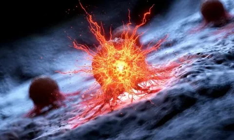 Một nhóm thuốc thông dụng có thể là vũ khí chống ung thư mới