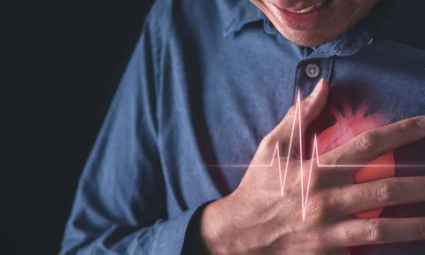 Phát hiện thêm nguyên nhân gây nhồi máu cơ tim