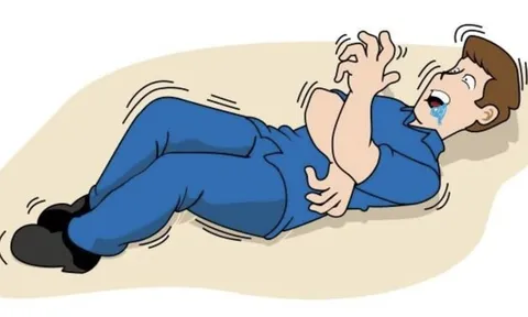 Té ngã và co giật, nam sinh 16 tuổi mắc động kinh khởi phát cục bộ