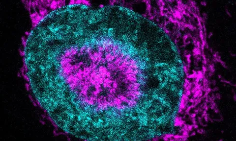 Phát hiện "chìa khóa" ngăn ung thư trước khi di căn