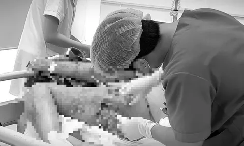 Nguy kịch sau khi tự trích mụn nhọt tại nhà