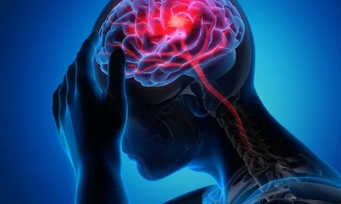 Hơn 99% các cơn đột quỵ và nhồi máu cơ tim liên quan 4 điều này