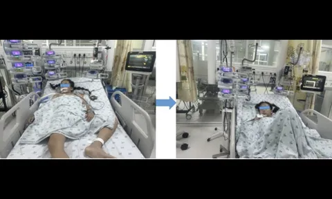 Bé gái ở An Giang mắc căn bệnh hiếm, với chưa đến 12 ca ở trẻ em được báo cáo trên y văn thế giới