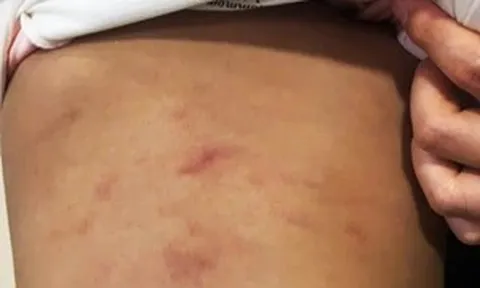 Tạm đình chỉ nhóm trẻ tư thục có trẻ bị bạo hành ở Cà Mau