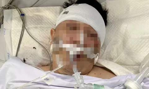 Luật sư lên tiếng vụ người đàn ông nguy kịch khi xe tông trúng chó chạy rông