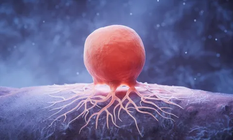 Thứ khiến chúng ta hạnh phúc có thể liên quan đến bệnh ung thư